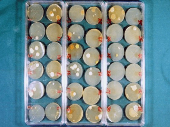 コロニー数カウント